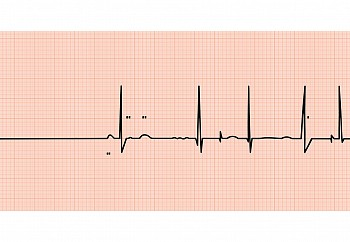 NAS Guide Us Upon The Straight Path