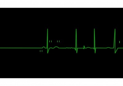 NAS Guide Us Upon The Str