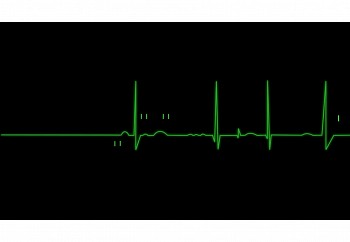 NAS Guide Us Upon The Str