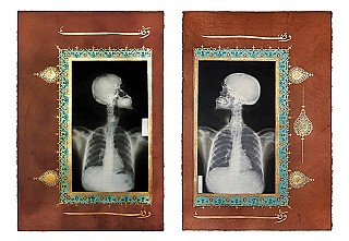 AHM Illuminations Madniate